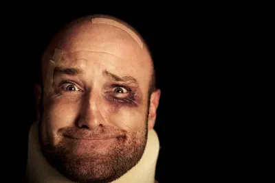 E rëndë / Gazetari investigativ dhunohet nga e ëma